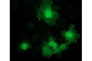 Immunofluorescence (IF) image for anti-Alcohol Dehydrogenase 1B (Class I), beta Polypeptide (ADH1B) antibody (ABIN1496478) (ADH1B antibody)