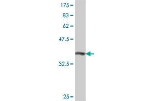 Western Blot detection against Immunogen (37. (RASGRP2 antibody  (AA 65-164))