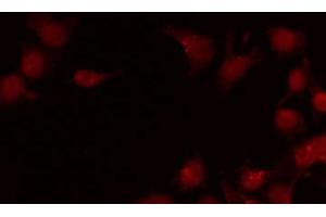 ABIN6269138 staining LOVO by IF/ICC. (SRF antibody  (N-Term))