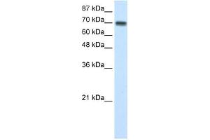 CARS antibody used at 1 ug/ml to detect target protein. (CARS antibody  (N-Term))
