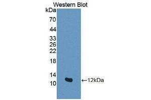 Detection of Recombinant GTF2H5, Human using Polyclonal Antibody to General Transcription Factor IIH, Polypeptide 5 (GTF2H5) (GTF2H5 antibody  (AA 1-71))