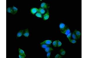 Immunofluorescence staining of Hela cells with ABIN7173574 at 1:200, counter-stained with DAPI. (TNNI3 antibody  (AA 2-210))