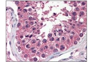 Immunohistochemistry (IHC) image for anti-Uracil-DNA Glycosylase (UNG) (AA 1-313), (N-Term) antibody (ABIN317576) (UNG antibody  (N-Term))