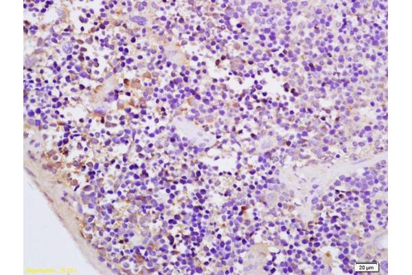 CMKLR1 antibody  (AA 151-250)
