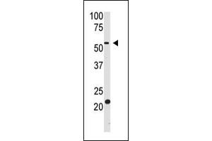 The anti-BACE2 Ctr Pab (ABIN390067 and ABIN2840591) is used in Western blot to detect BACE2 in HL60 cell lysate.