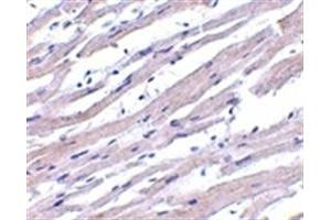 Image no. 1 for anti-Apoptotic Peptidase Activating Factor 1 (APAF1) (AA 12-28) antibody (ABIN205853) (APAF1 antibody  (AA 12-28))