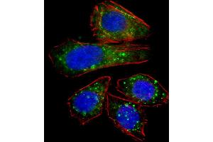Fluorescent confocal image of U251 cell stained with ZNF81 Antibody (N-term). (ZNF81 antibody  (N-Term))
