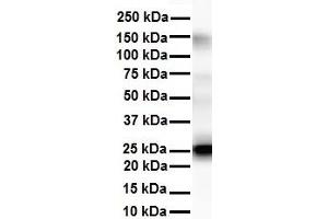 WB Suggested Anti-Tmed1 antibody Titration: 1 ug/mL Sample Type: Human liver (TMED1 antibody  (N-Term))