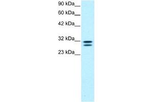 WB Suggested Anti-HTATIP2 Antibody Titration:  0.