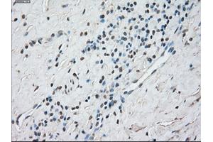 Immunohistochemical staining of paraffin-embedded Kidney tissue using anti-STAT1 mouse monoclonal antibody. (STAT1 antibody)