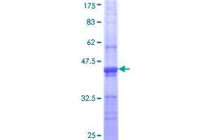 Clathrin Heavy Chain (CLTC) (AA 232-340) protein (GST tag)
