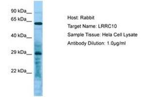 LRRC10 antibody  (C-Term)