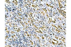 IHC analysis of Filamin B/FLNB using anti-Filamin B/FLNB antibody (ABIN7601606). (FLNB antibody  (AA 397-701))