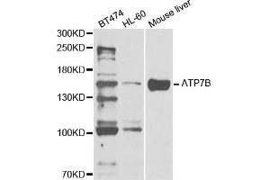 Western Blotting (WB) image for anti-ATPase, Cu++ Transporting, beta Polypeptide (ATP7B) antibody (ABIN1876877) (ATP7B antibody)