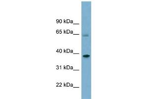 WB Suggested Anti-SNX7 Antibody Titration: 0. (Sorting Nexin 7 antibody  (Middle Region))