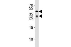 SIRT3 antibody western blot analysis in 293 cell lysate. (SIRT3 antibody  (AA 250-279))