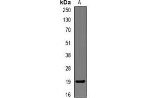 Western blot analysis of CAP18 expression in mouse liver (A) whole cell lysates.