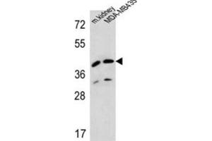 Western Blotting (WB) image for anti-L-2-Hydroxyglutarate Dehydrogenase (L2HGDH) antibody (ABIN2995585) (L2HGDH antibody)