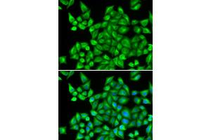 Immunofluorescence analysis of HeLa cells using DHRS9 antibody (ABIN5973740).