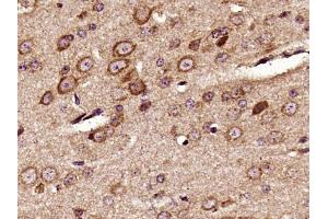 Paraformaldehyde-fixed, paraffin embedded mouse brain, Antigen retrieval by boiling in sodium citrate buffer (pH6) for 15min, Block endogenous peroxidase by 3% hydrogen peroxide for 30 minutes,  Blocking buffer (normal goat serum) at 37°C for 20min, Antibody incubation with Pyk2 (Tyr402) Polyclonal Antibody (bs-3400R) at 1:400 overnight at 4°C, followed by a conjugated secondary and DAB staining. (PTK2B antibody  (pTyr402))