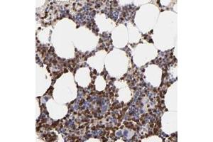 Immunohistochemical staining of human bone marrow with NCF2 polyclonal antibody  shows strong cytoplasmic positivity in bone marrow poietic cells. (NCF2 antibody)