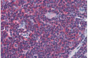 Human Tonsil: Formalin-Fixed, Paraffin-Embedded (FFPE) (Arrestin 3 antibody  (AA 300-410))