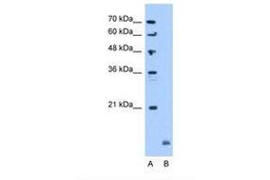 Image no. 1 for anti-Crystallin, alpha B (CRYAB) (C-Term) antibody (ABIN321397) (CRYAB antibody  (C-Term))