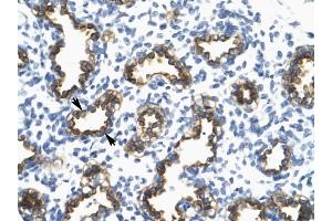 RFP2 antibody was used for immunohistochemistry at a concentration of 4-8 ug/ml to stain Alveolar cells {arrows) in Human Lung.