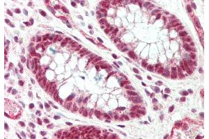 Rabbit Anti-Srrm1 antibody  Formalin Fixed Paraffin Embedded Tissue: Human Colon Primary antibody Concentration: 1:100 Secondary Antibody: Donkey anti-Rabbit-Cy3 Secondary Antibody Concentration: 1:200 Magnification: 20x Exposure Time: 0. (SRRM1 antibody  (C-Term))