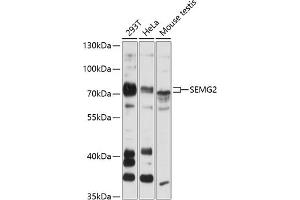 Western blot analysis of extracts of various cell lines, using SEMG2 antibody (ABIN6128756, ABIN6147529, ABIN6147531 and ABIN6216592) at 1:3000 dilution. (SEMG2 antibody  (AA 383-582))