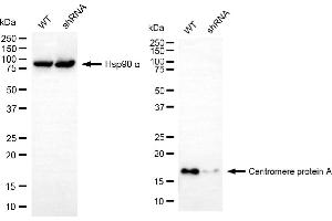 Western blotting analysis using centromere protein A antibody (ABIN7798023).