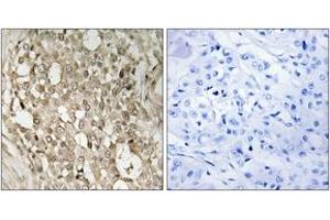 Immunohistochemistry (IHC) image for anti-Nuclear Factor-kB p65 (NFkBP65) (pSer529) antibody (ABIN2888481) (NF-kB p65 antibody  (pSer529))