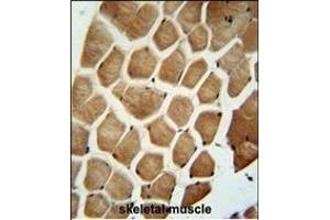 WDR49 antibody (C-term) (ABIN654826 and ABIN2844501) immunohistochemistry analysis in formalin fixed and paraffin embedded human skeletal muscle followed by peroxidase conjugation of the secondary antibody and DAB staining. (WDR49 antibody  (C-Term))