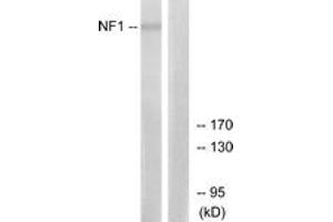 Western blot analysis of extracts from HepG2 cells, using NF1 Antibody. (Neurofibromin 1 antibody  (AA 1551-1600))