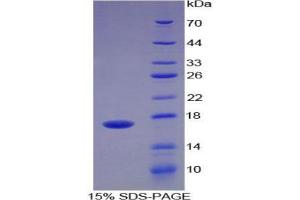 SDS-PAGE analysis of Human ADAMTS4 Protein.