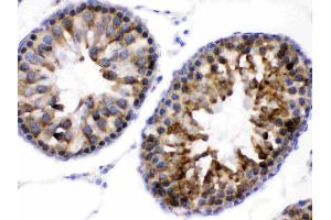 WNK1 was detected in paraffin-embedded sections of rat testis tissues using rabbit anti-WNK1 Antigen Affinity purified polyclonal antibody (Catalog # ) at 1 ? (WNK1 antibody  (Middle Region))