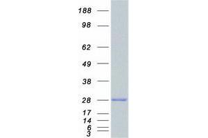 Validation with Western Blot