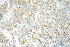 anti-Adenylate Kinase 4 (AK4) antibody