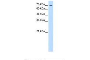 Image no. 1 for anti-Transglutaminase 2 (C Polypeptide, Protein-Glutamine-gamma-Glutamyltransferase) (TGM2) (N-Term) antibody (ABIN6738366) (Transglutaminase 2 antibody  (N-Term))