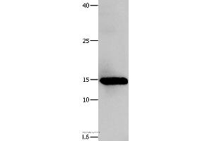 Western blot analysis of Human fetal muscle tissue, using LGALS1 Polyclonal Antibody at dilution of 1:500 (LGALS1/Galectin 1 antibody)