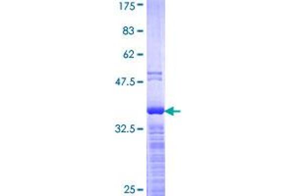 YBX1 Protein (AA 51-139) (GST tag)