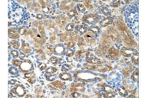 UBXD2 antibody was used for immunohistochemistry at a concentration of 4-8 ug/ml. (UBXD2 antibody  (Middle Region))