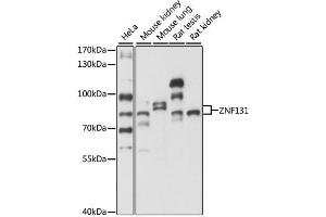Western blot analysis of extracts of various cell lines, using ZNF131 antibody. (ZNF131 antibody)