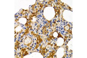 Immunohistochemistry of paraffin-embedded rat lung using TFF1 antibody (ABIN5970904) at dilution of 1/200 (40x lens). (TFF1 antibody)
