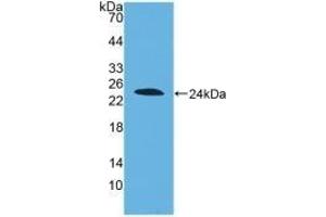Detection of Recombinant DISC1, Human using Polyclonal Antibody to Disrupted In Schizophrenia 1 (DISC1) (DISC1 antibody  (AA 102-261))