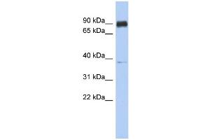 WB Suggested Anti-CCDC157 Antibody Titration: 0. (CCDC157 antibody  (Middle Region))