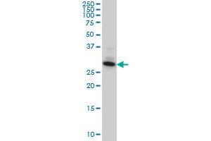 SUMF2 monoclonal antibody (M02), clone 4B3 Western Blot analysis of SUMF2 expression in A-431 . (SUMF2 antibody  (AA 26-125))