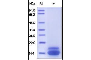 Human TRAIL R2, His Tag on SDS-PAGE under reducing (R) condition. (TNFRSF10B Protein (AA 56-182) (His tag))