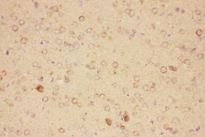 Anti-CNTF Picoband antibody,  IHC(P): Rat Brain Tissue (CNTF antibody  (AA 2-200))