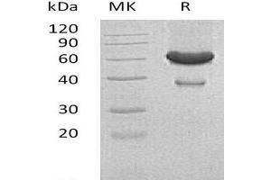 Ephrin A1 Protein (EFNA1) (His tag,Fc Tag)